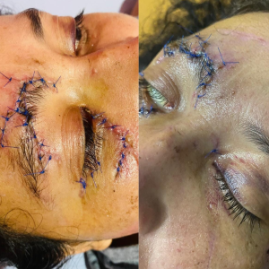 Accident victim and dedicated educator seeks community help for recovery