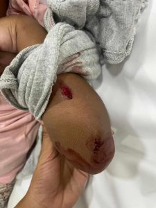 Toddler wounded by stray bullet during New Year’s Eve fireworks in Belize City