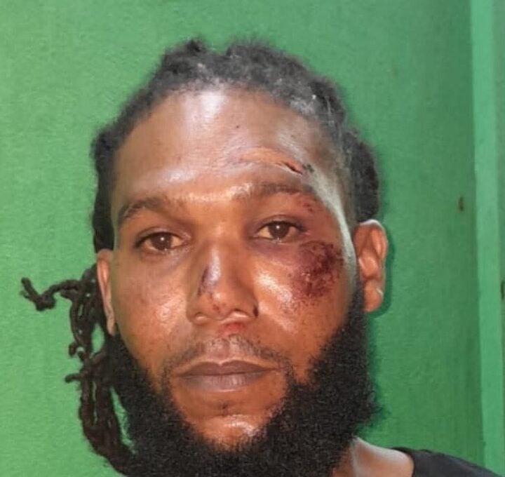Stanley Flowers charged after shooting Police officer outside Belize City nightclub