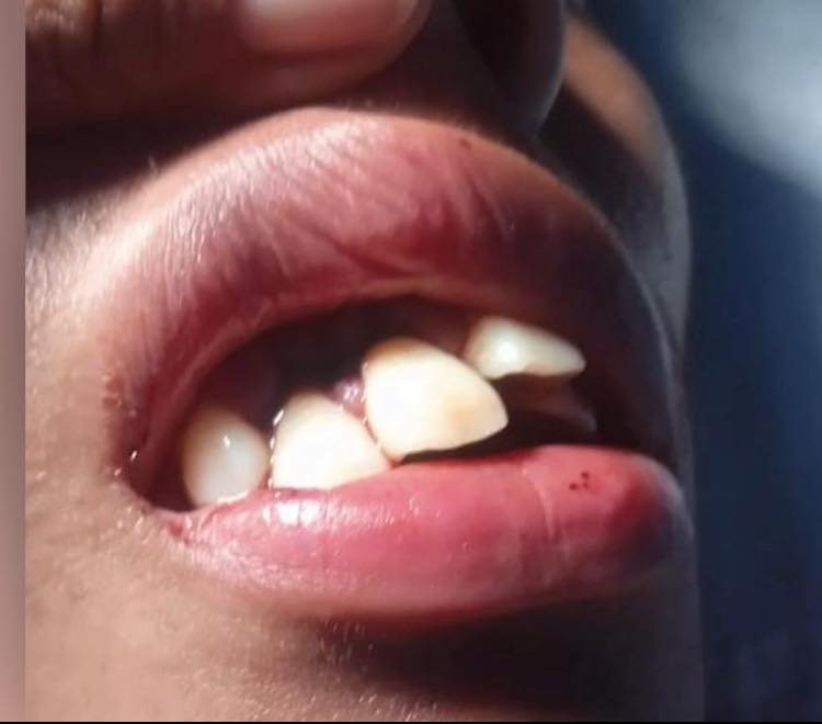 Teen speaks out after Said "Badi" Guerra granted bail: “I’m traumatized, and he’s free”