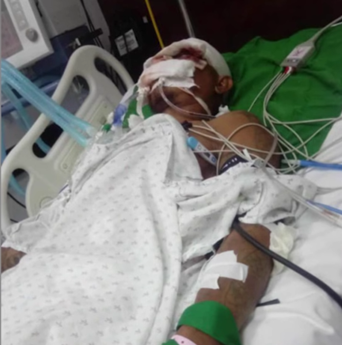 Father of two fights for life after being knocked off bike by tanker truck